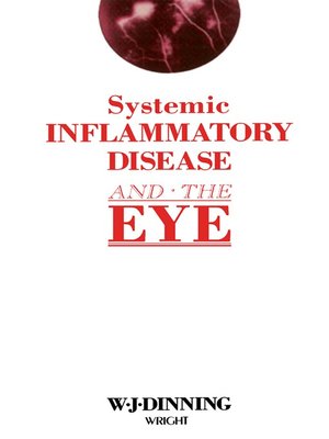 cover image of Systemic Inflammatory Disease and the Eye
